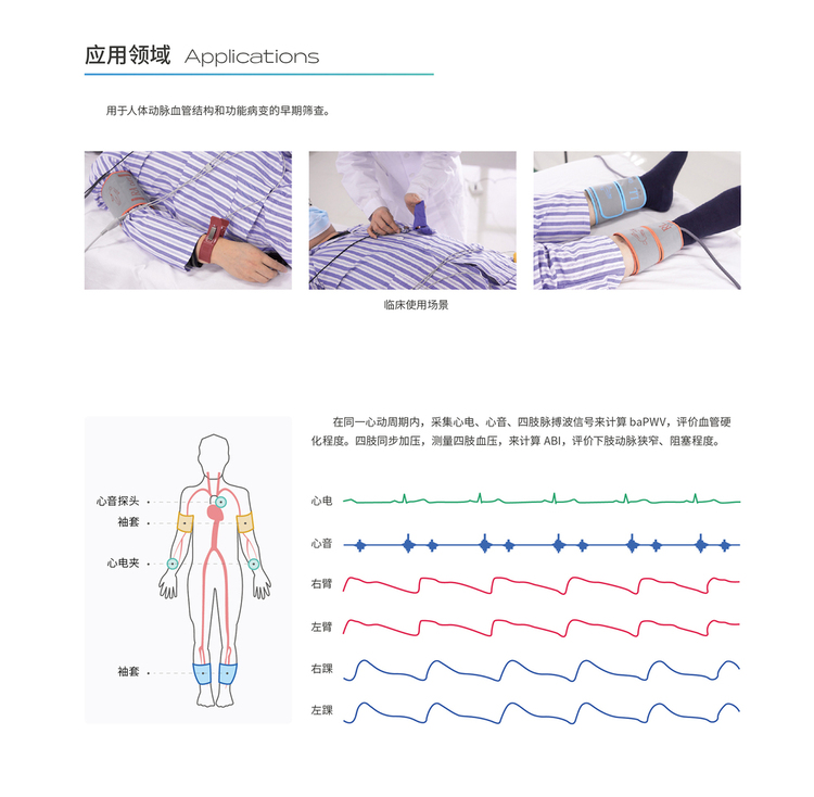 动脉硬化检查仪功能