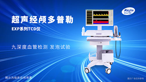 超声经颅多普勒价格